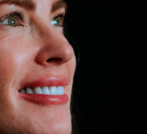 Implantes Dentários