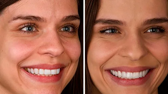 O Padrão Estético de Referência Mundial